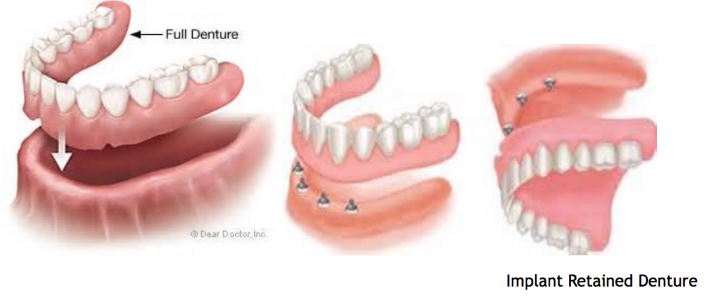 Services - Dentistry of Olde Towne